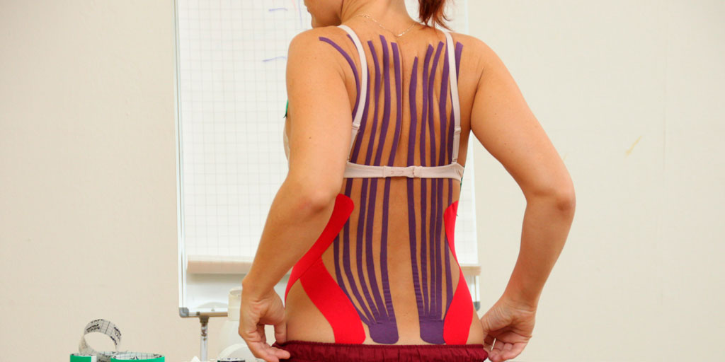 Схема наложения тейпов на спину при похудении