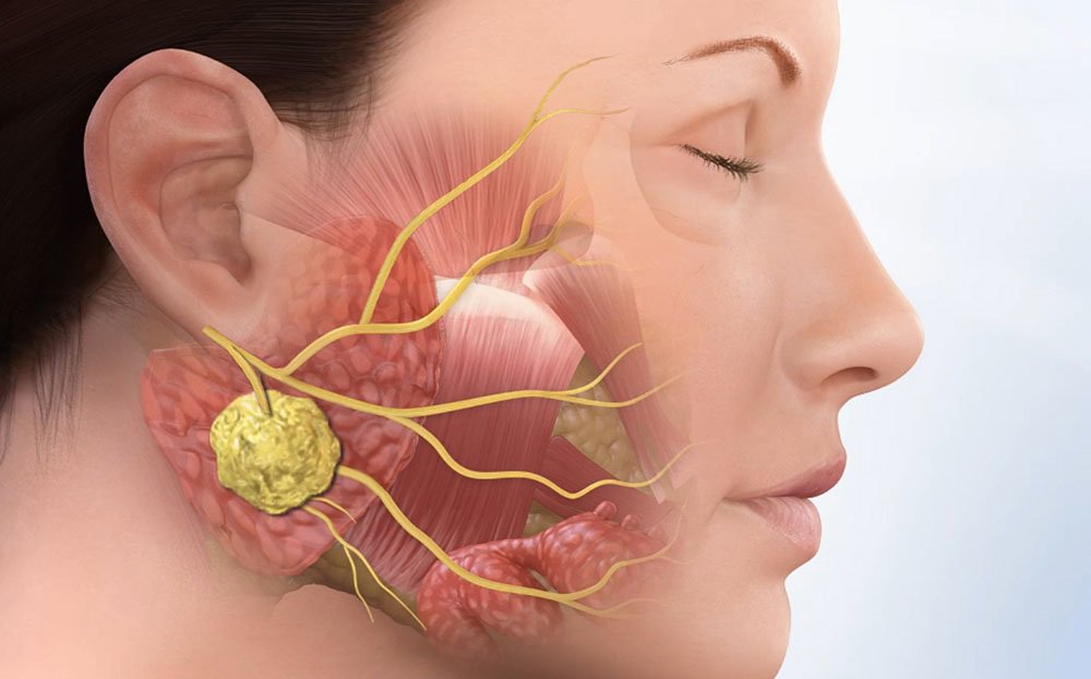 Причины появления невралгии лицевог нерва 