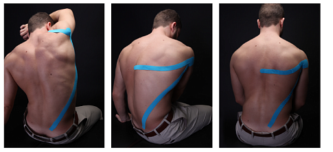 Тейпирование широчайшей мышцы спины
