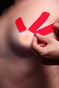 Тейпирование мышц груди и молочной железы для подтяжки