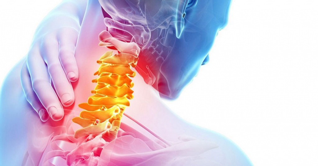 Шейный остеохондроз ✔️: симптомы, признаки и лечение остеохондроза шейного отдела
