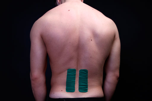 Возникновение мышечной боли в спине и ее лечение